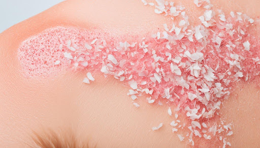 A flakey skin with red patches